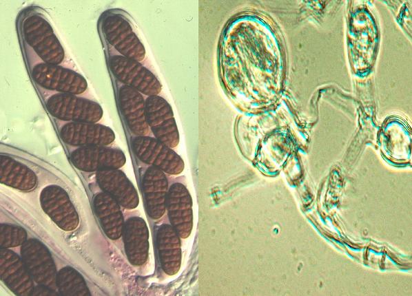Fotos microscopio de ascas bitunicada  y prototunicada